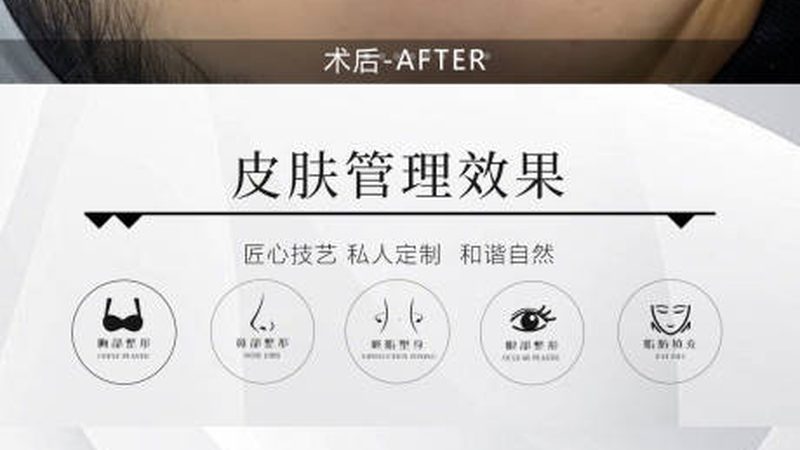 医美整形合同有效期多久