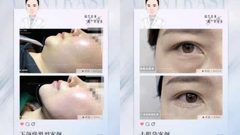 轻医美抗衰项目适合多大年龄