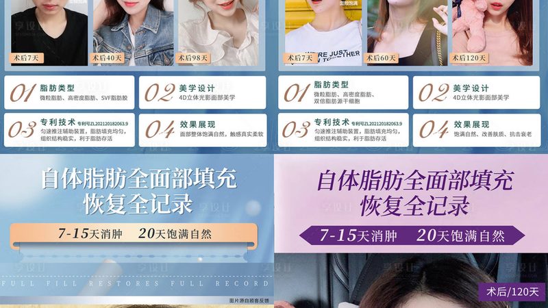 超声炮术后效果显现时间揭秘**