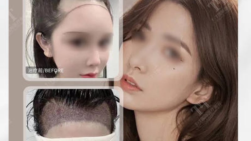 手术室不是装修间，美容外科的硬门槛在哪