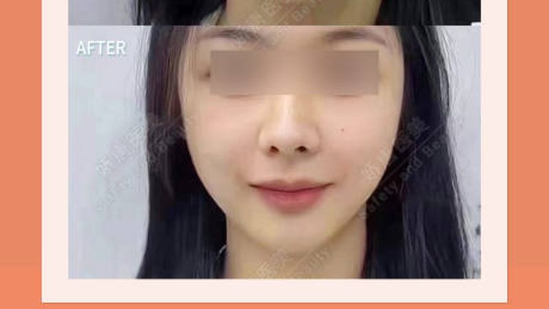 医美咨询师加盟院长：揭秘经验与成长之路