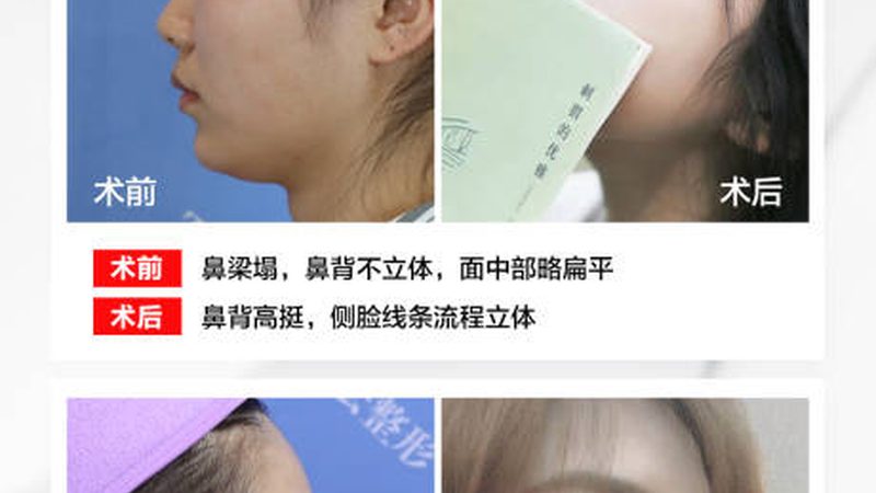 热玛吉机器租赁公司推荐