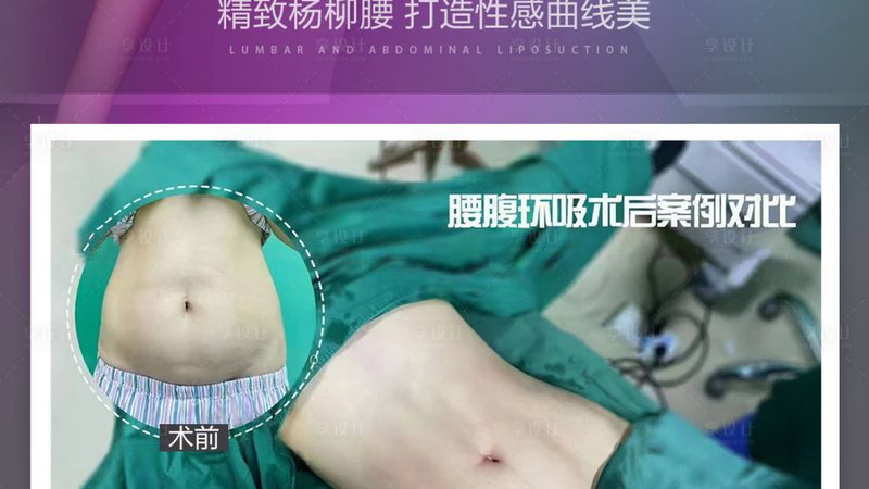 轻医美产品批发注意事项