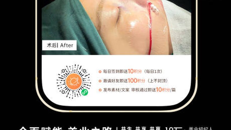 成都双眼皮手术：揭秘排名前十的医院选择标准