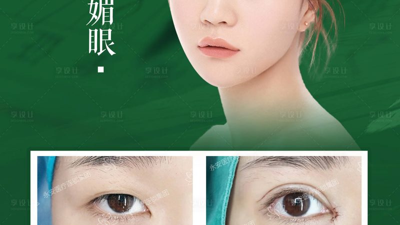小标题：医美行业的“试金石