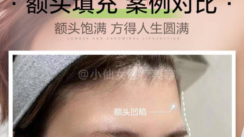 根据以上标准，以下列出轻医美仪器厂家直销的十大品牌，供消费者参考：